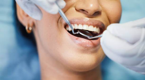 Best Emergency TMJ Treatment in Brisbane, CA